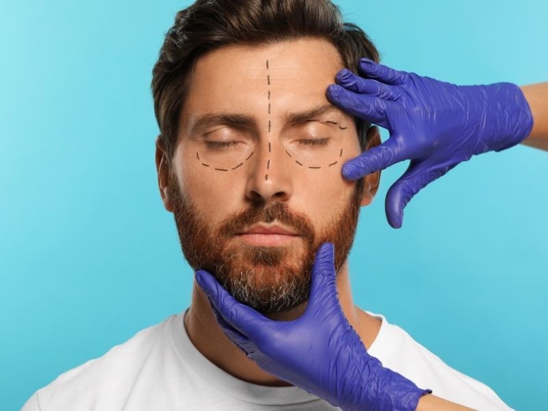 erkeklerde-rinoplastide-kisiye-ozel-planlama-neden-gereklidir
